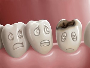3 novedades en caries dental